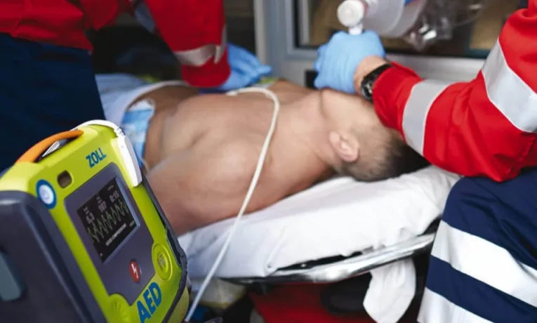 реанімація