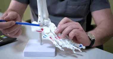 деформація стопи