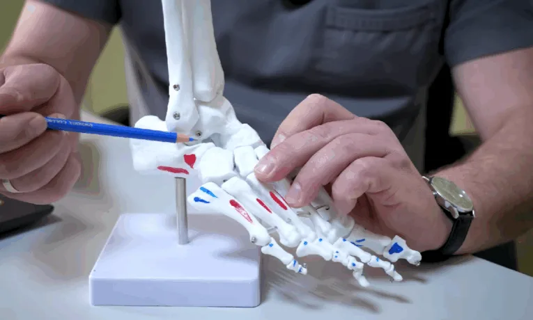 деформація стопи