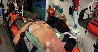 реанімували чоловіка