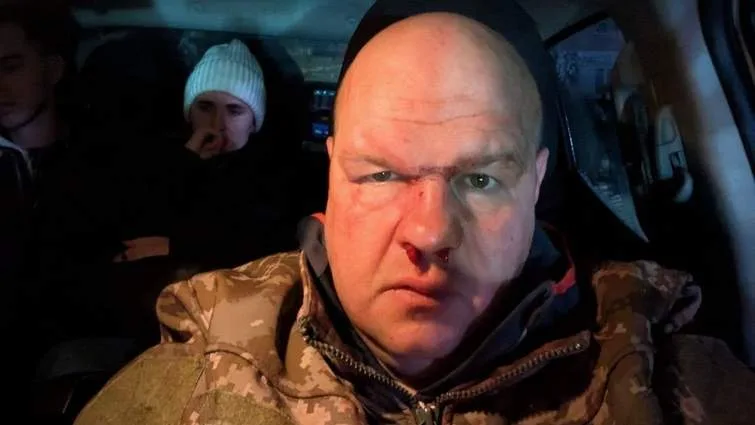 У Кременці мажори жорстоко побили майора ЗСУ