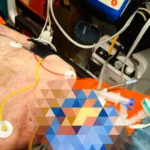 У Тернополі медики врятували чоловіка, в якого зупинилось серце