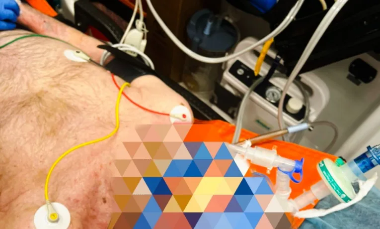 У Тернополі медики врятували чоловіка, в якого зупинилось серце