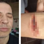 У Тернопільському ТЦК чоловік порізав руку бритвою