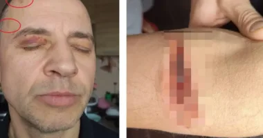 У Тернопільському ТЦК чоловік порізав руку бритвою